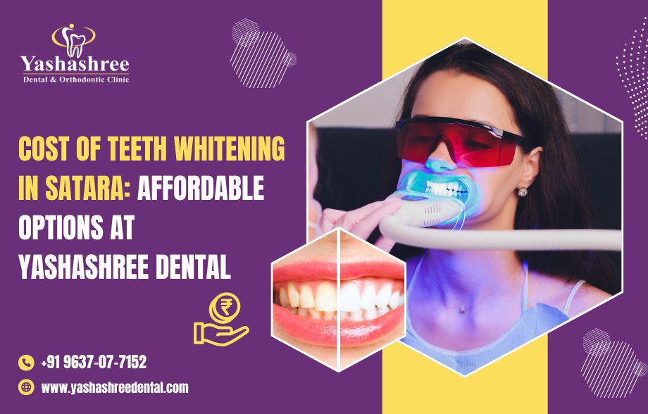  Cost of Teeth Whitening in Satara: Affordable Options at Yashashree Dental