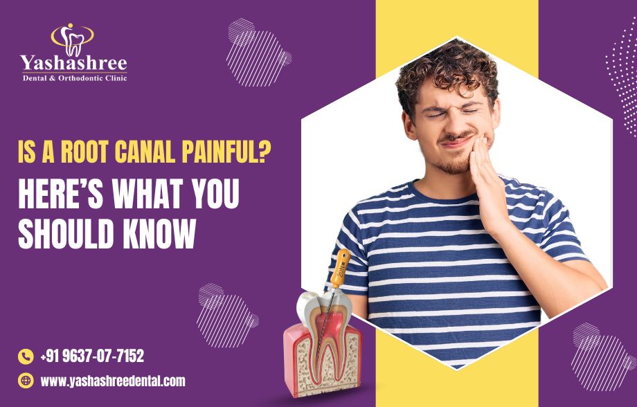  Is A Root Canal Painful? Here’s What You Should Know