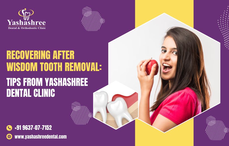 Recovering After Wisdom Tooth Removal: Tips From Yashashree Dental Clinic