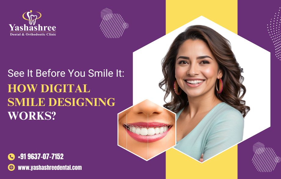  See It Before You Smile It: How Digital Smile Designing Works