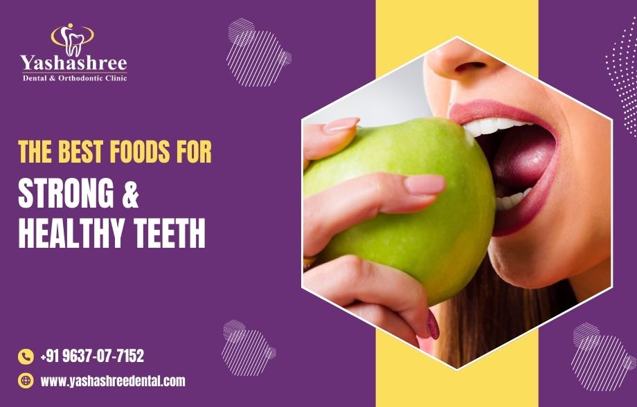 The Best Foods for Strong and Healthy Teeth