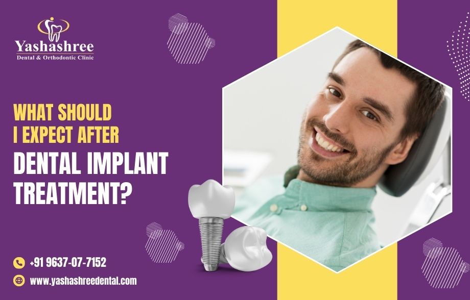 What Should You Expect After Dental Implant Treatment?