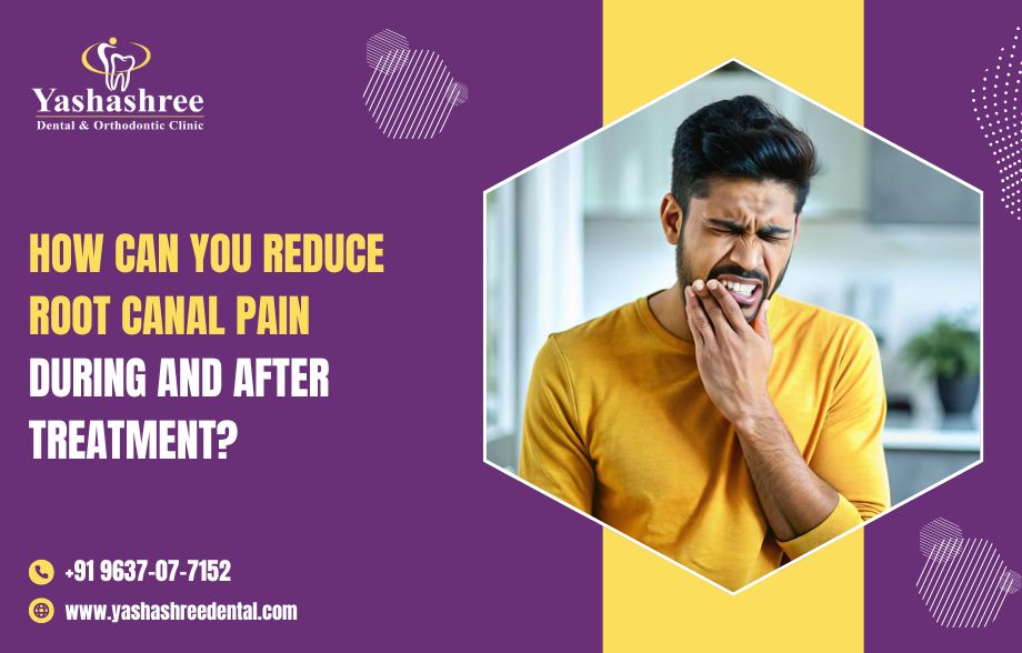 How Can You Reduce Root Canal Pain During and After Treatment?