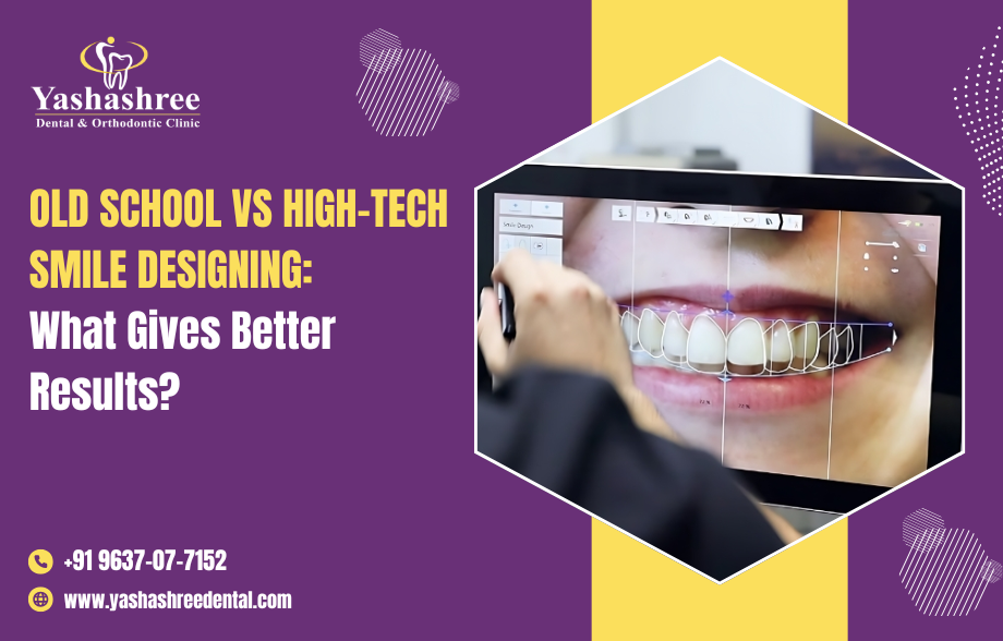 Old School vs High-Tech Smile Designing: What Gives Better Results?