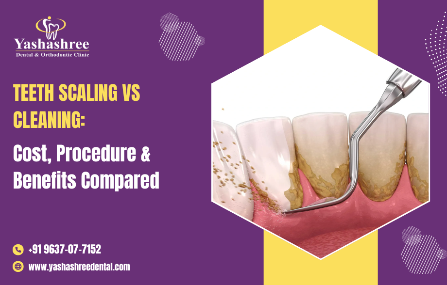 Teeth Scaling vs Cleaning: Cost, Procedure & Benefits Compared