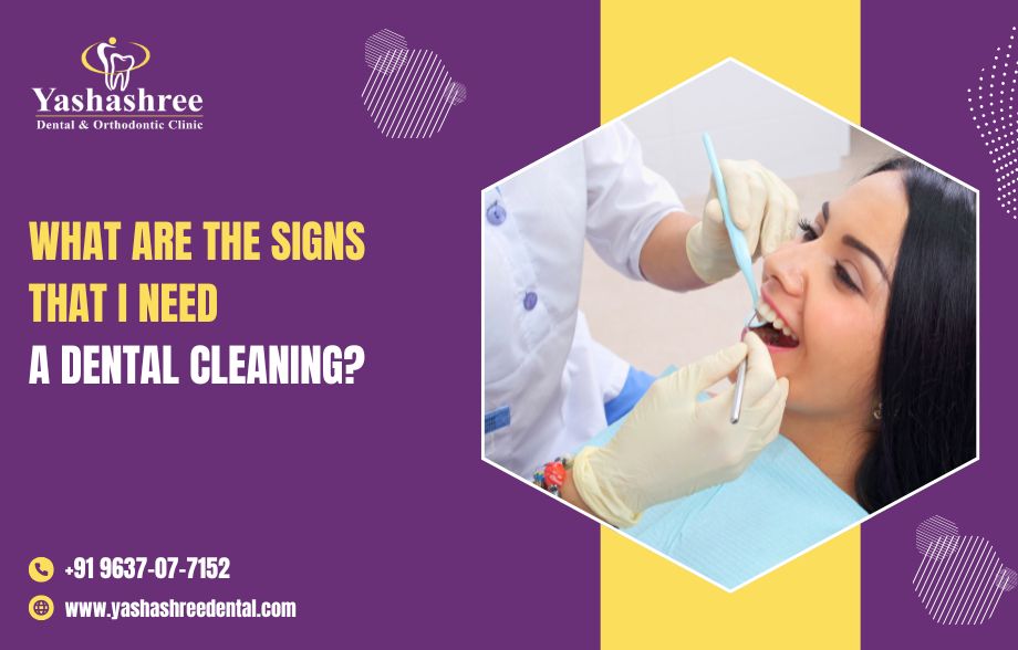 What are the signs that I need a dental cleaning?